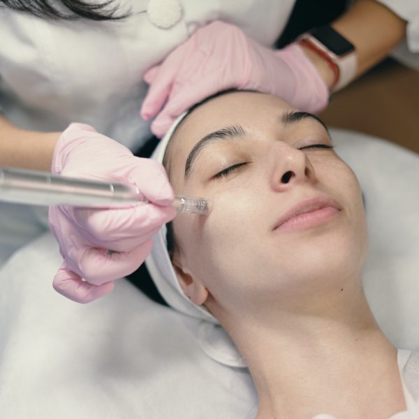 Kosmetikerin führt eine Microneedling-Behandlung im Gesicht einer Kundin durch